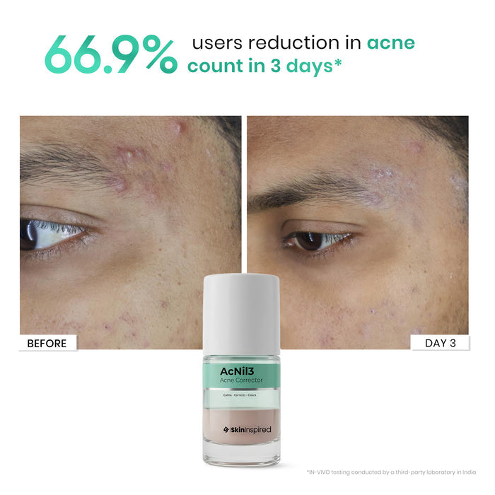 AcNil3 Acne Spot Corrector (12ml)