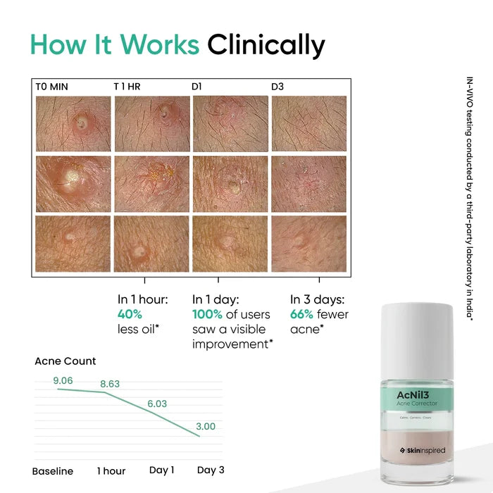 AcNil3 Acne Spot Corrector (12ml)