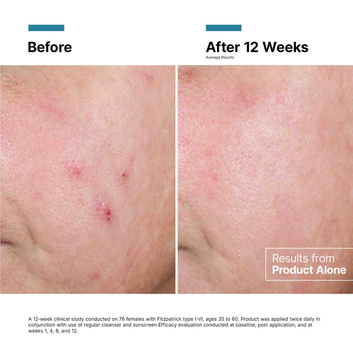 Before and after results of using SkinCeuticals Advanced RGN-6 Regenerative Cream