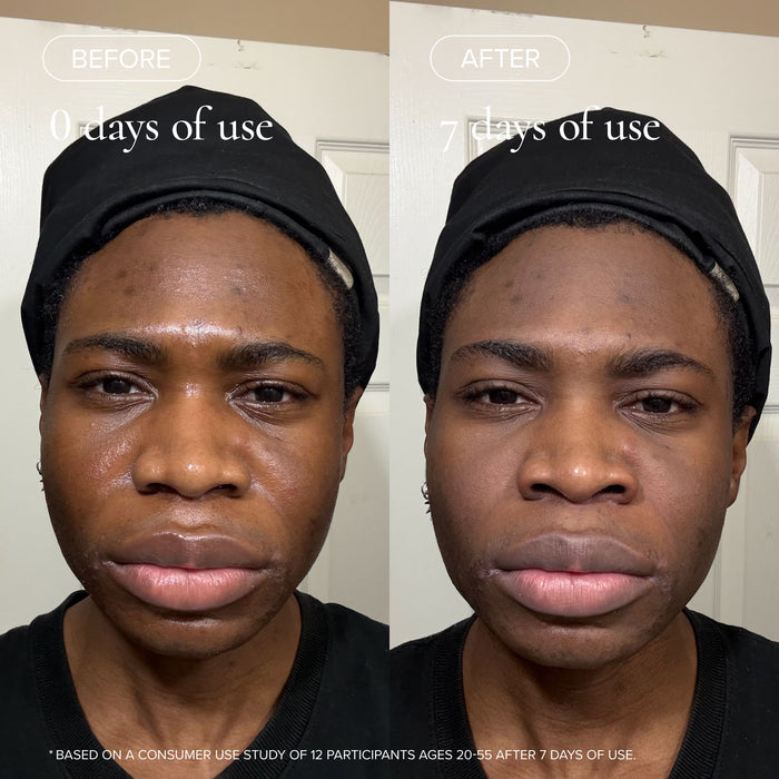 Before and after results of using   variant: Default Title