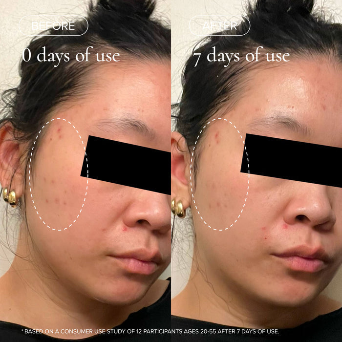 Before and after results of using   variant: Default Title
