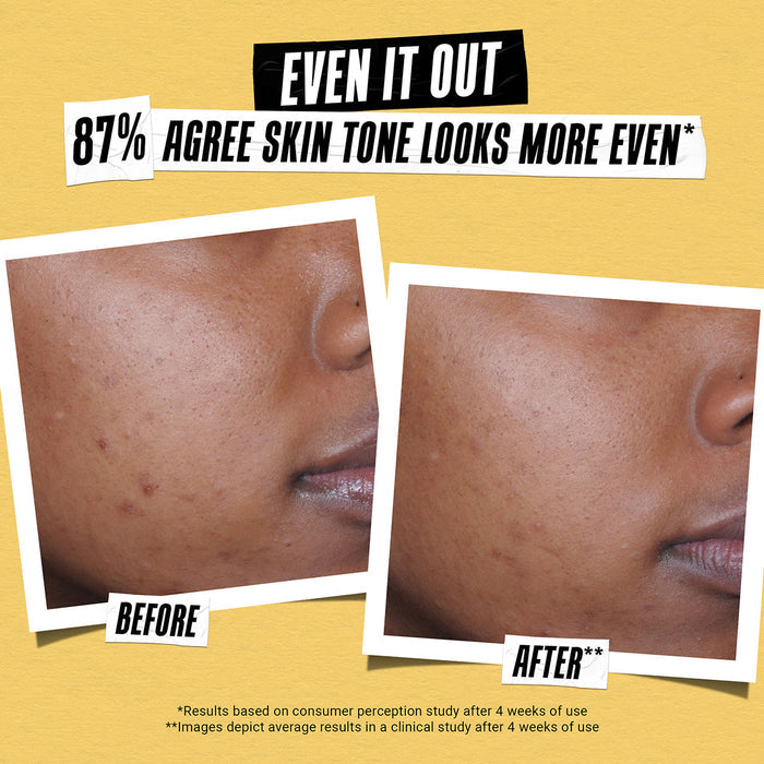 Before and after results of using Kiehl's Since 1851 Better Screen UV Serum SPF 50+