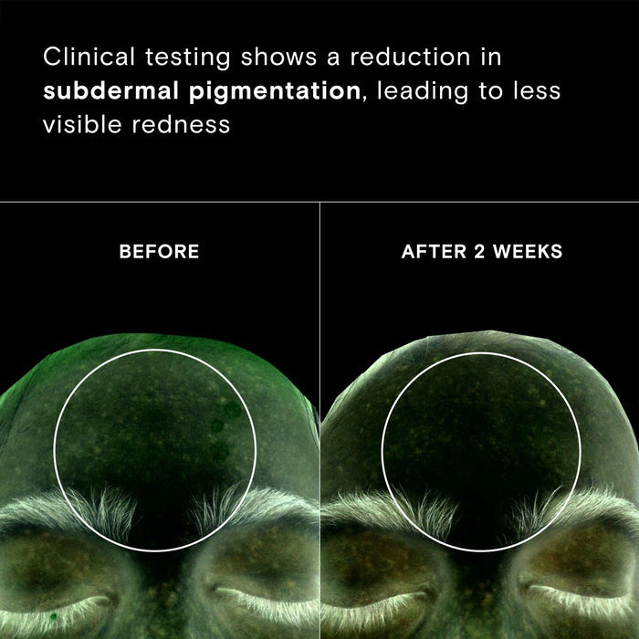 Before and after results of using Exponent Calm Revival Green Tea Resveratrol Power Serum