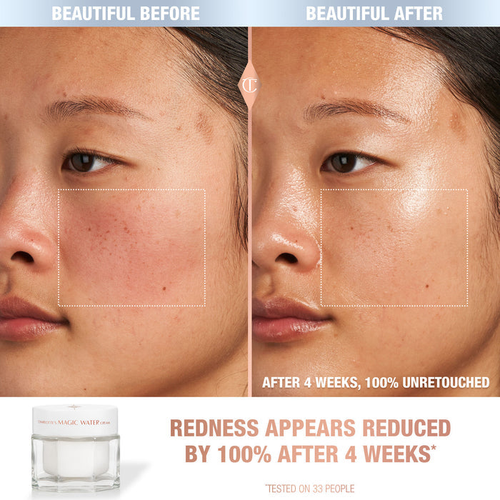 Before and after results of using Charlotte Tilbury 1 oz variant: 1 oz