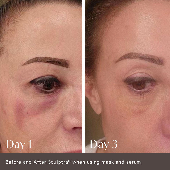 Before and after results of using Viktor Michael Ciao For Now Post Injection Care Mask