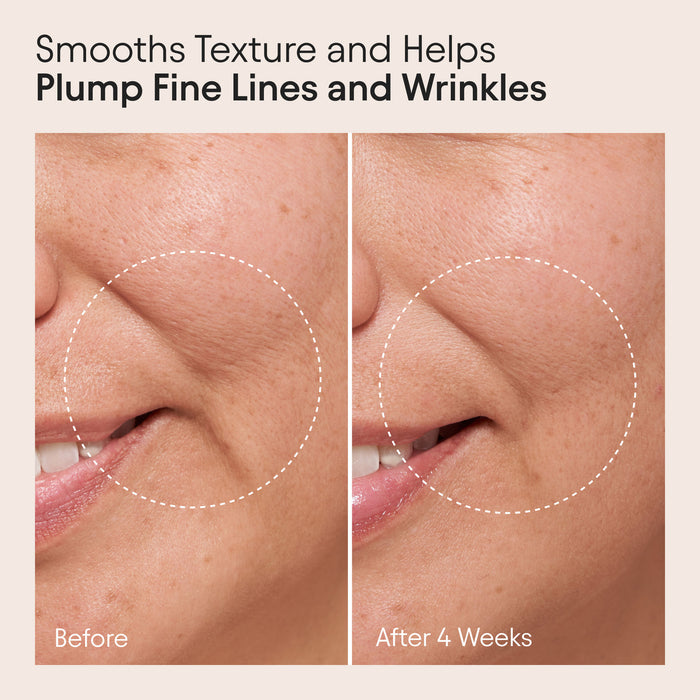 Before and after results of using Alpyn Beauty Clarifying Facial Oil with Retinol and Pink Algae
