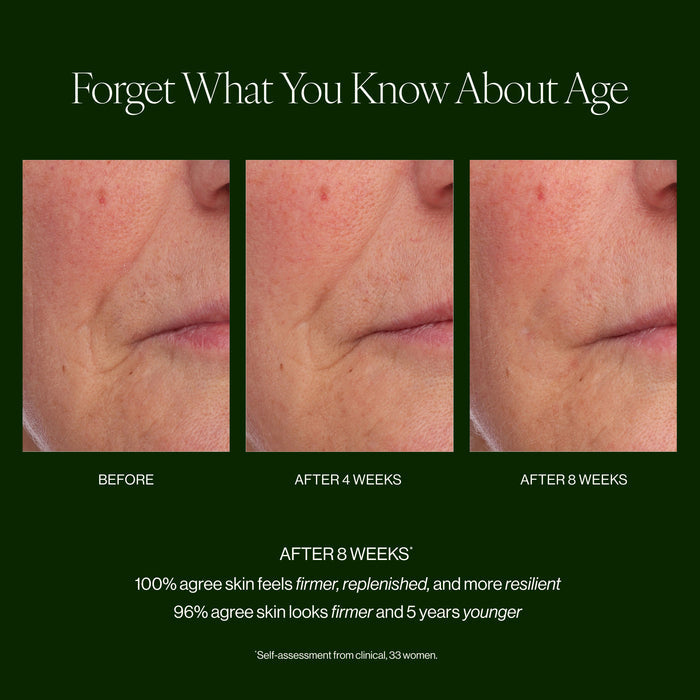Before and after results of using Tata Harper Crème Supreme