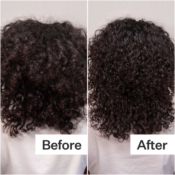 Before and after results of using Act+Acre Daily Hydro Scalp Serum with Hyaluronic Acid for Dry Scalp
