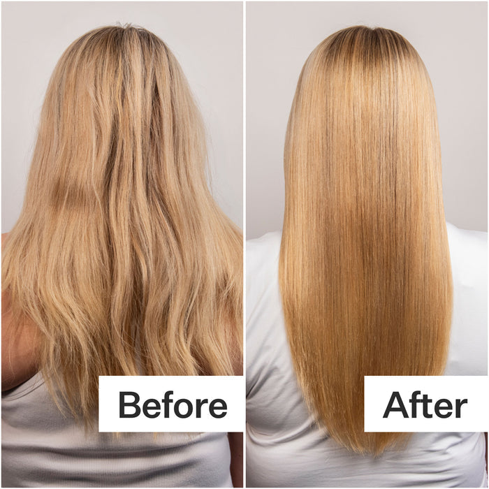 Before and after results of using Act+Acre Daily Hydro Scalp Serum with Hyaluronic Acid for Dry Scalp
