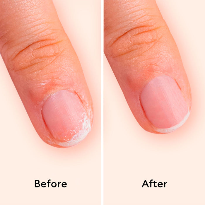 Before and after results of using Manucurist Day and Night Duo variant: Default Title