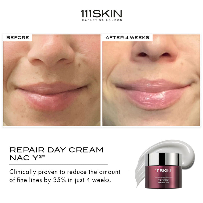 Before and after results of using   variant: 0.5 fl oz
