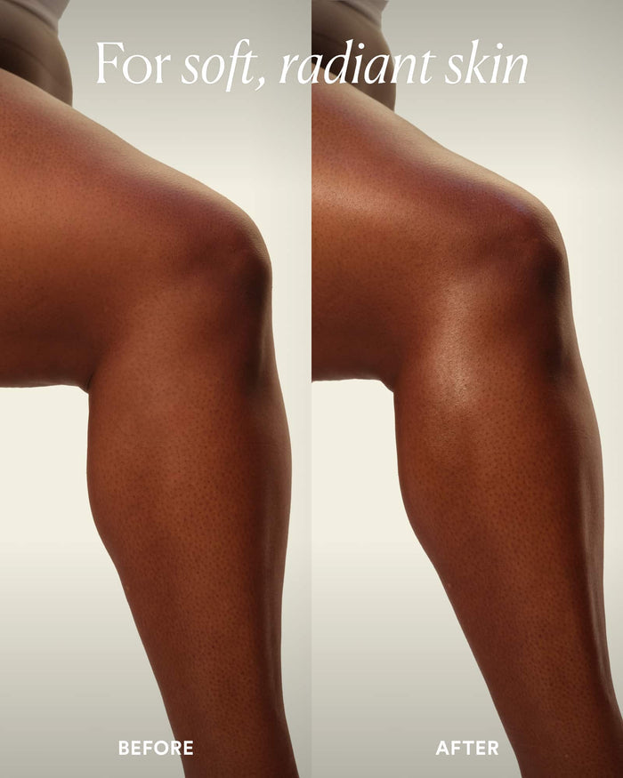Before and after comparison of soft, radiant skin on a person's arm.