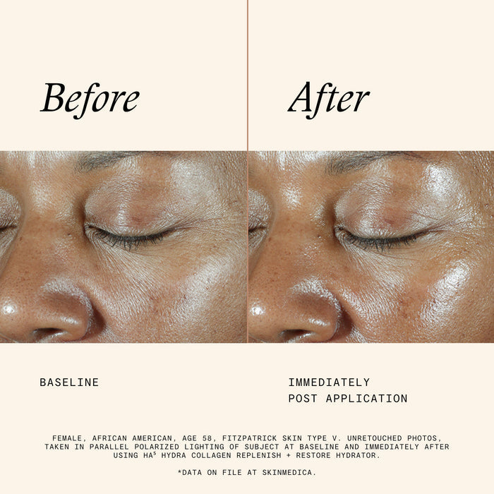 Information related to SkinMedica HA⁵ Hydra Collagen Hydrator with Vegan Collagen