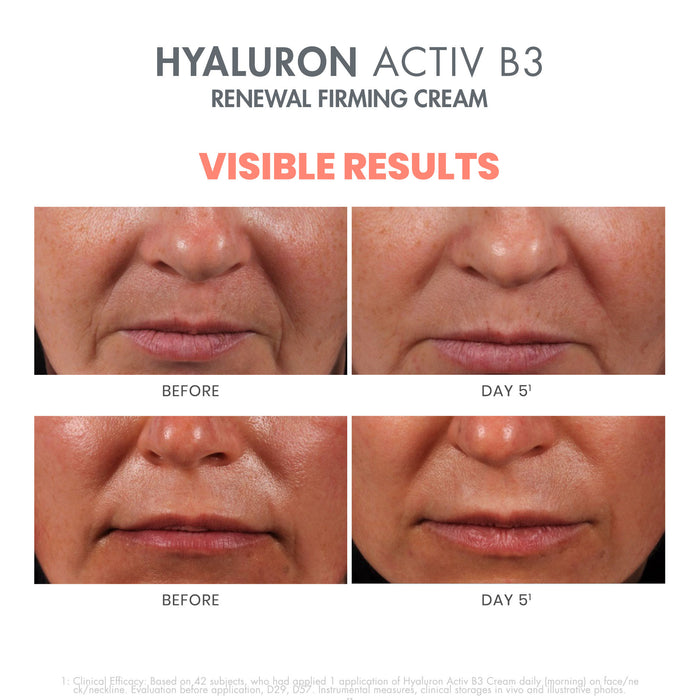Swatch image of   variant: 1.6 fl oz