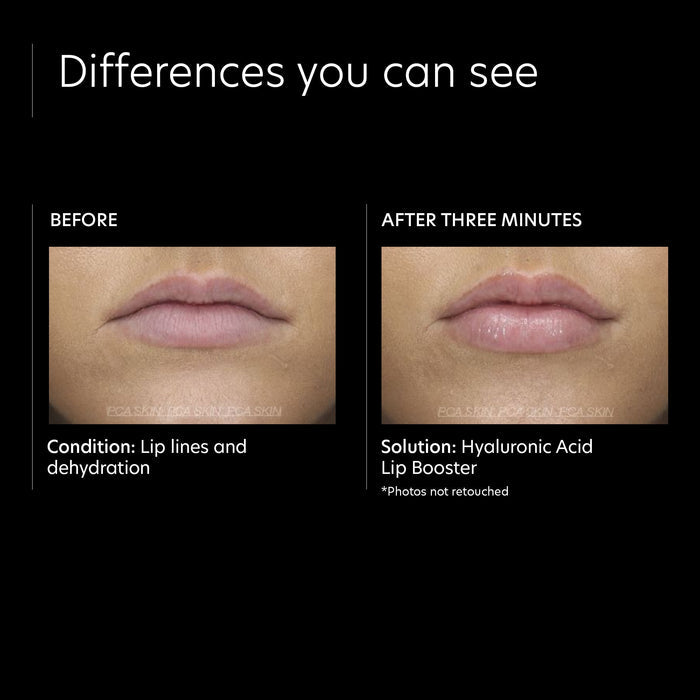 Before and after results of using PCA Skin Hyaluronic Acid Lip Booster
