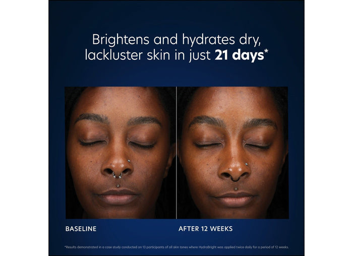 Before and after results of using PCA Skin HydraBright Moisturizer