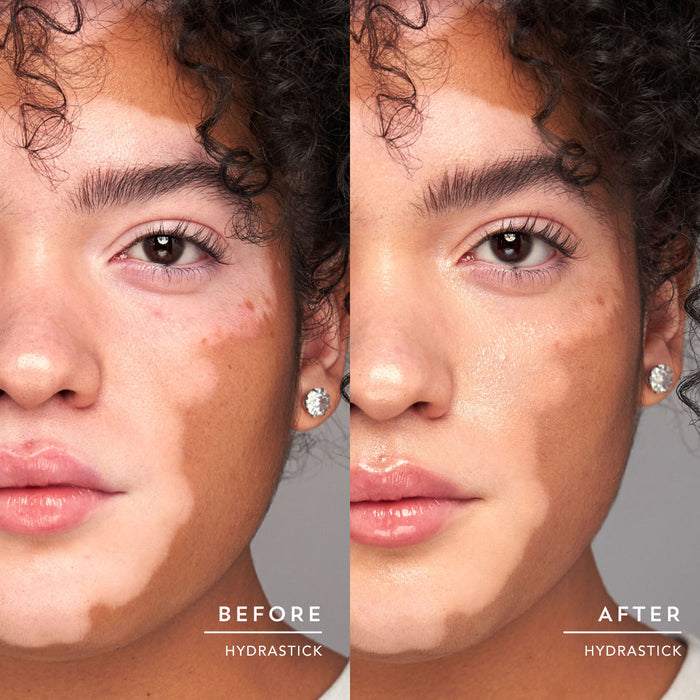 Before and after results of using Indie Lee Hydrastick
