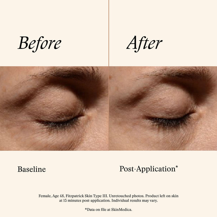 Information related to SkinMedica Instant Bright Eye Cream