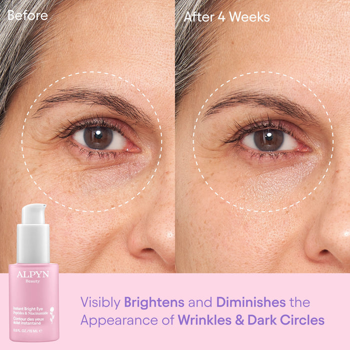 Before and after results of using Alpyn Beauty Instant Bright Eye with Peptides and Niacinamide