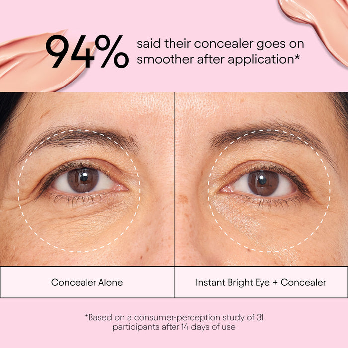 Before and after results of using Alpyn Beauty Instant Bright Eye with Peptides and Niacinamide