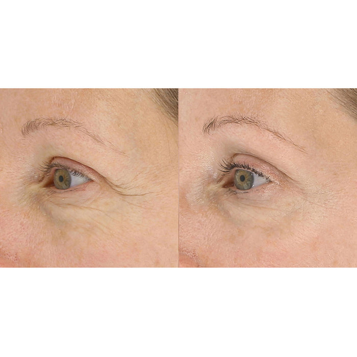 Model image of LightStim LightStim for Wrinkles