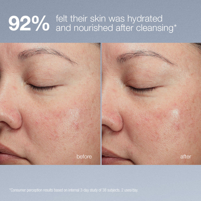 Before and after results of using Dermalogica Magnetic [+] Afterglow Cleanser