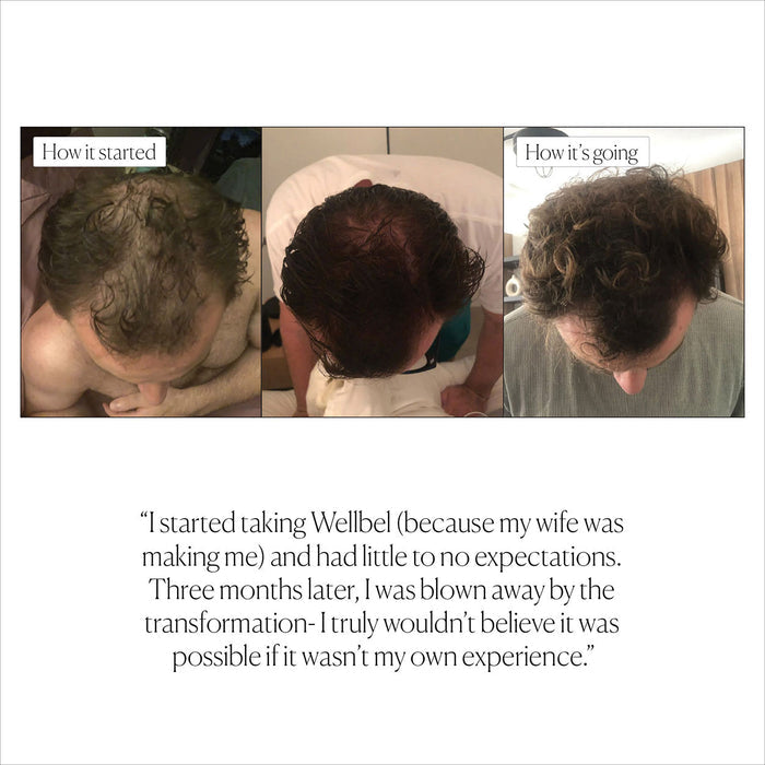 Before and after results of using Wellbel Men
