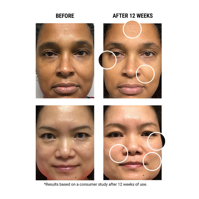 Lifestyle image of Kiehl's Since 1851 Micro-Dose Anti-Aging Retinol Serum With Ceramides and Peptide