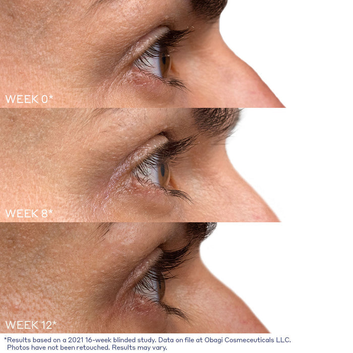 Before and after results of using Obagi Nu-Cil Eyelash Enhancing Serum