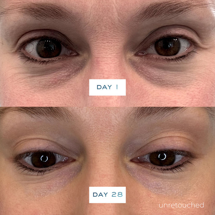 Before and after results of using Element Eight O2 Vitamin C Brighten Defend Serum