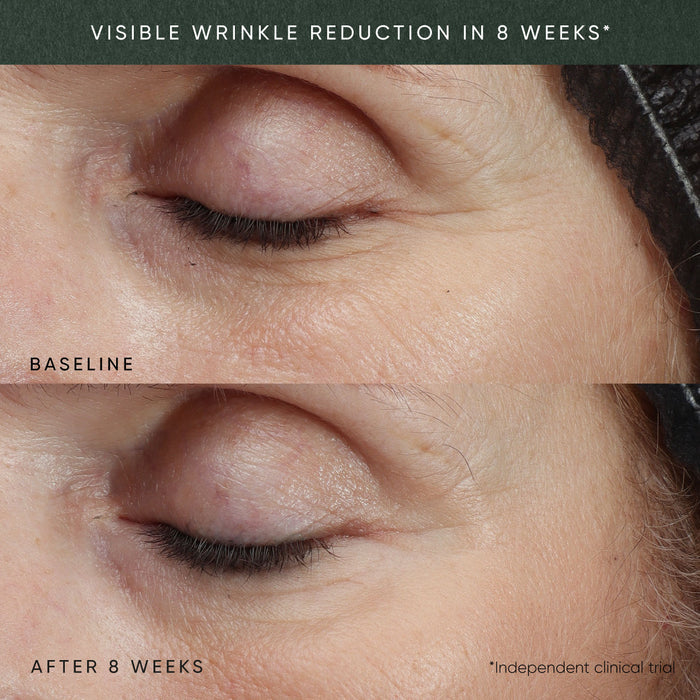 Before and after results of using Irene Forte Phytomelatonin Rejuvenating Eye Cream