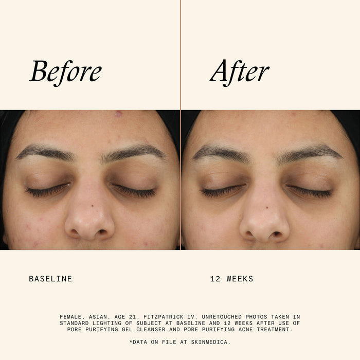 Lifestyle image of SkinMedica Pore Purifying Gel Cleanser
