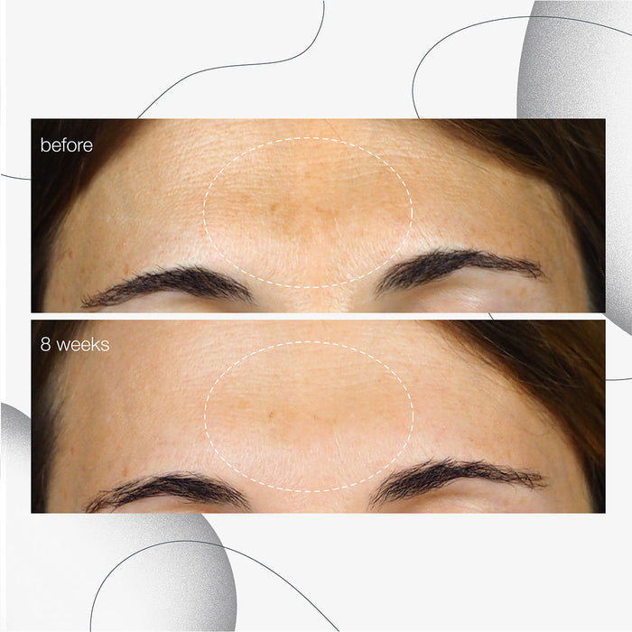 Model image of Dermalogica PowerBright Dark Spot Serum