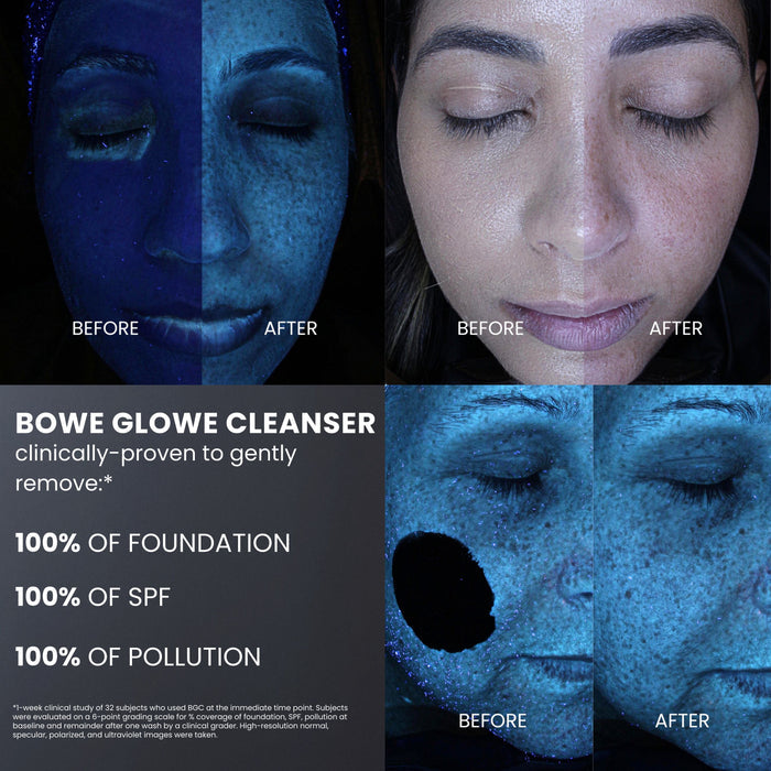 Before and after results of using Dr. Whitney Bowe Beauty Procedure Enhancement Program variant: Default Title