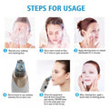 Professional Electric Blackhead Remover Vacuum | Deep Pore Cleansing Facial Tool