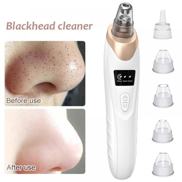 Professional Electric Blackhead Remover Vacuum | Deep Pore Cleansing Facial Tool