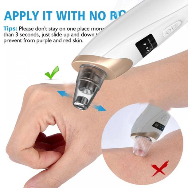 Professional Electric Blackhead Remover Vacuum | Deep Pore Cleansing Facial Tool