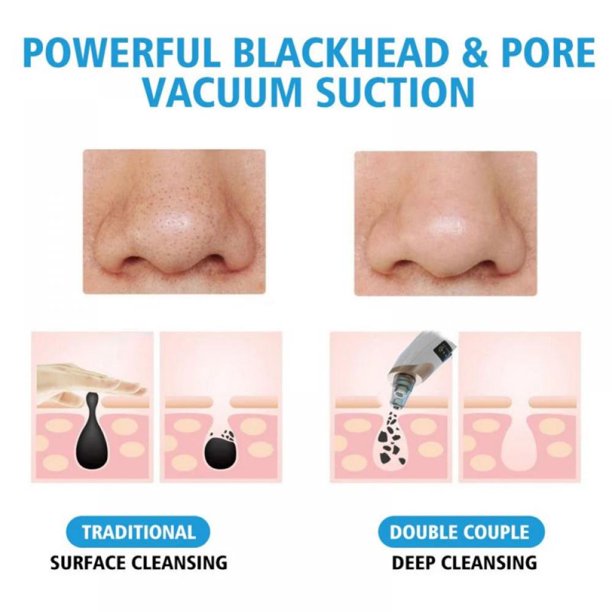 Professional Electric Blackhead Remover Vacuum | Deep Pore Cleansing Facial Tool