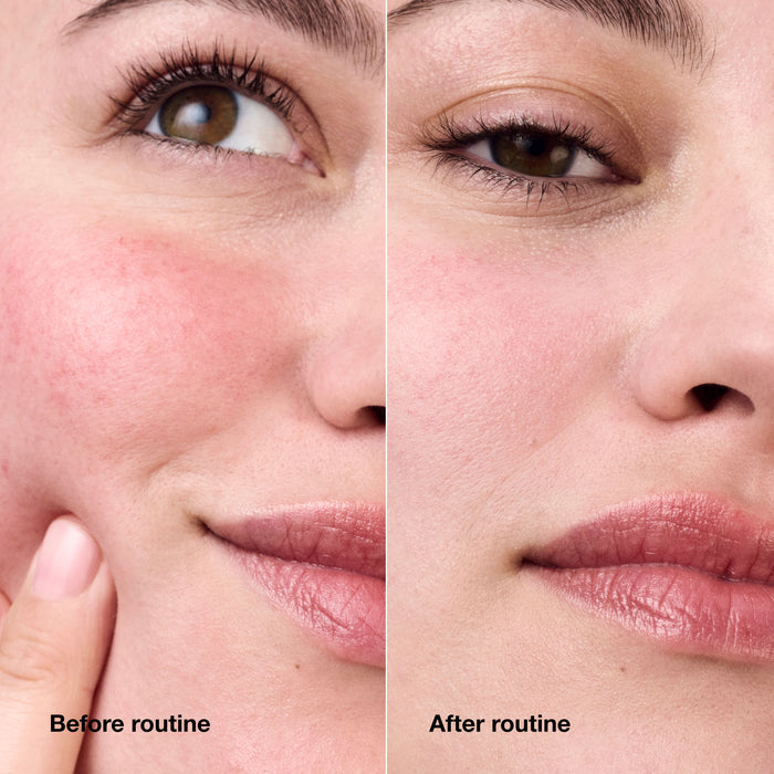 Before and after results of using Clinique Redness Solutions Daily Relief Cream With Probiotic Technology