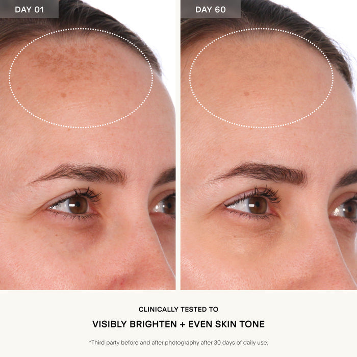 Before and after results of using   variant: 1.7 oz