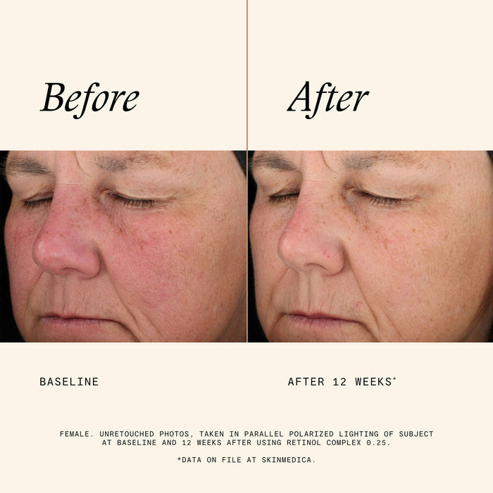 Information related to SkinMedica Retinol Complex 0.25
