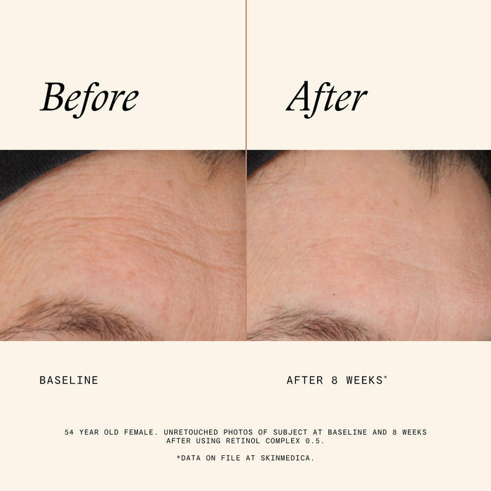 Information related to SkinMedica Retinol Complex 0.5
