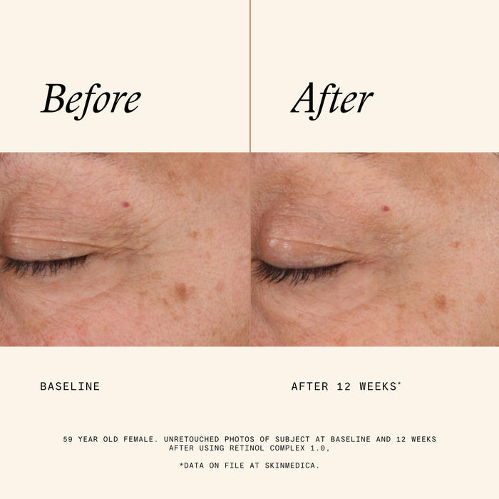 Information related to SkinMedica Retinol Complex 1.0