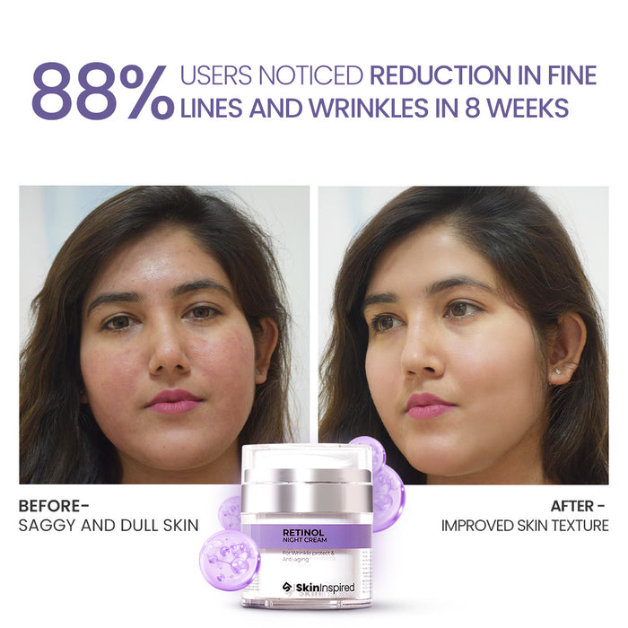 "SkinInspired Retinol Night Cream (50g) – anti-aging night cream for all skin types that moisturizes, reduces visible signs of aging, and supports epidermal regeneration for firmer, rejuvenated skin.