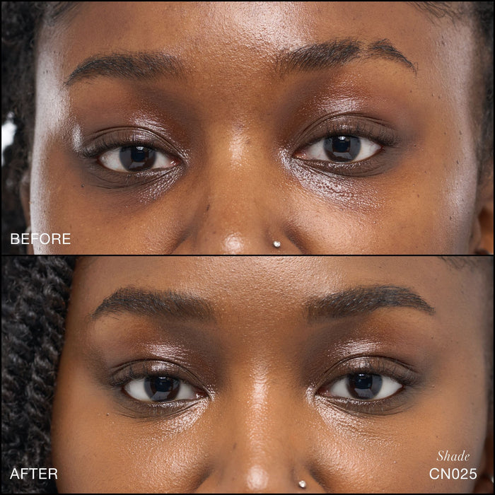 Before and after results of using RMS Beauty CN025 variant: CN025