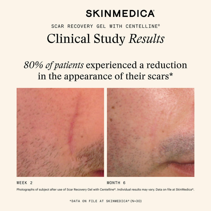 Before and after results of using SkinMedica Scar Recovery Gel