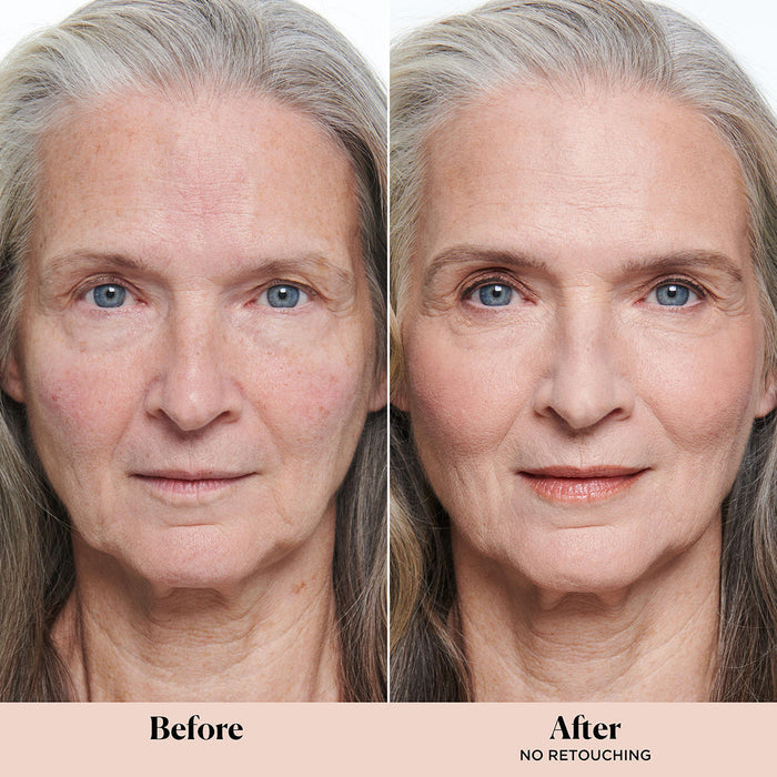 Before and after results of using Laura Mercier Secret Camouflage Concealer Duo Stick variant: 1C