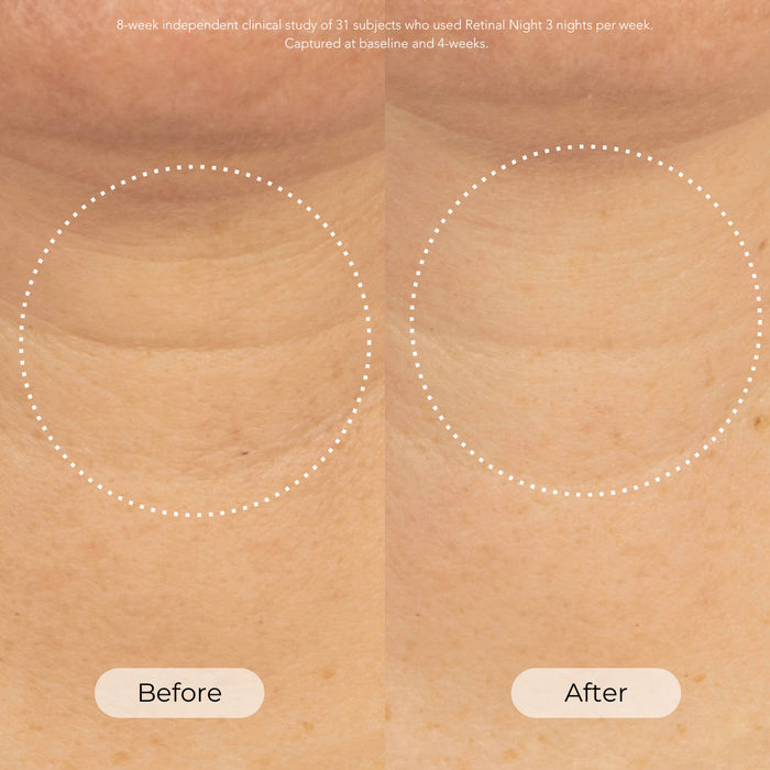 Before and after results of using Dr. Whitney Bowe Beauty Skin Cycling Program