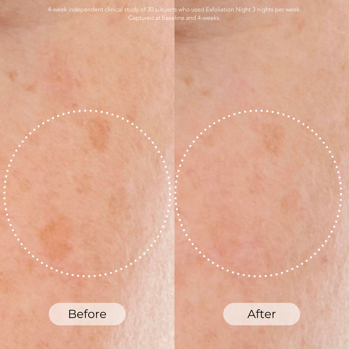 Before and after results of using Dr. Whitney Bowe Beauty Skin Cycling Program