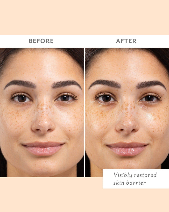Before and after results of using Patchology Skin Remedy Barrier-Boosting Sheet Mask - Single variant: Single